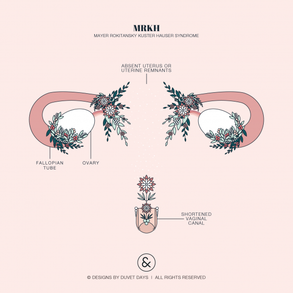 What is MRKH? – MRKH Connect